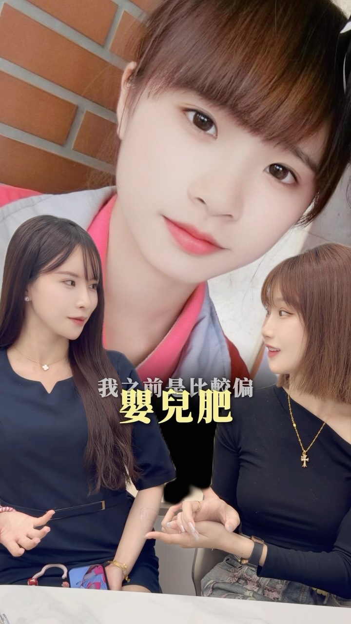 很多寶寶困擾的嬰兒肥、嘴邊肉、下顎線
以前我也有這種困擾😩😩
但是通過電波+音波 雙重緊緻
在用ONDA溶脂 & 肉毒提升
就可以改變原本的臉型&輪廓 ✨
每個人需要的療程內容都不一樣
所以建議大家要到現場給專業的醫生評估!
針對你們所需要的做加強🫶🏻💕 #醫美分享 #台中醫美 縮圖