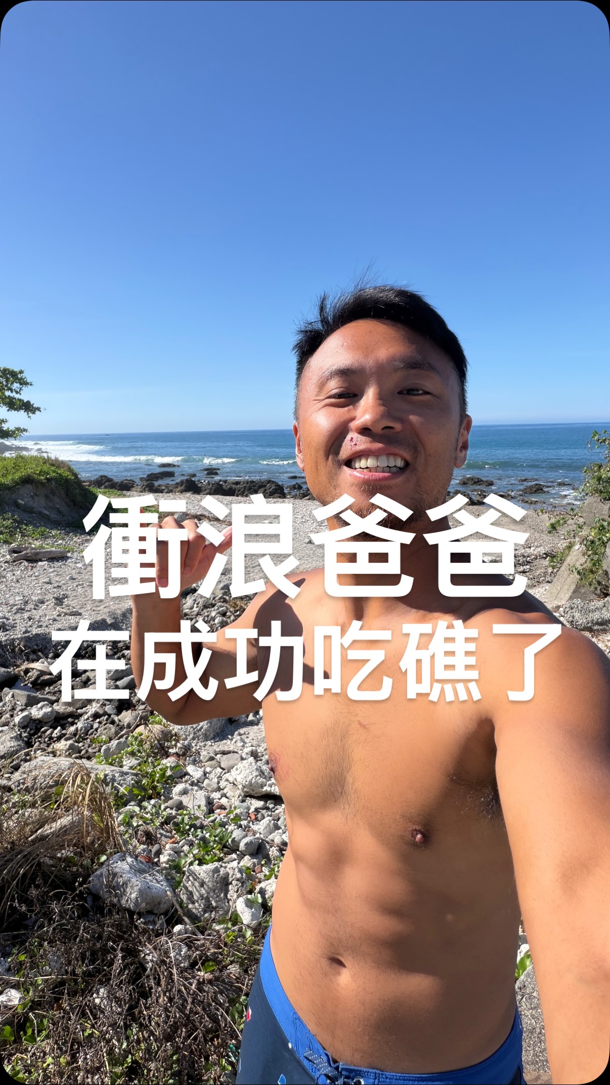 受到颱風白海豚外圍環流影響，台東的浪越來越大
Period 拉到 12 秒以上，成功也開始出現漂亮的長浪

沒想到，下第一道浪就出事了

為了閃開前方的礁石，我的腳繩接續繩直接被礁石割斷
衝浪板直接噴飛，卡在礁石上

還好當時剛好set結束，我趕快游回岸邊
結果上岸時又因為石頭青苔太滑，直接摔了一跤
臉上掛彩了

幸好只是擦傷，沒有更嚴重的意外
算是不幸中的大幸
這顆白海豚能量真的很強
浪越來越大，真的要量力而為

#衝浪爸爸 
#衝浪日常 
#白海豚 
#颱風浪
#SurfFit 縮圖