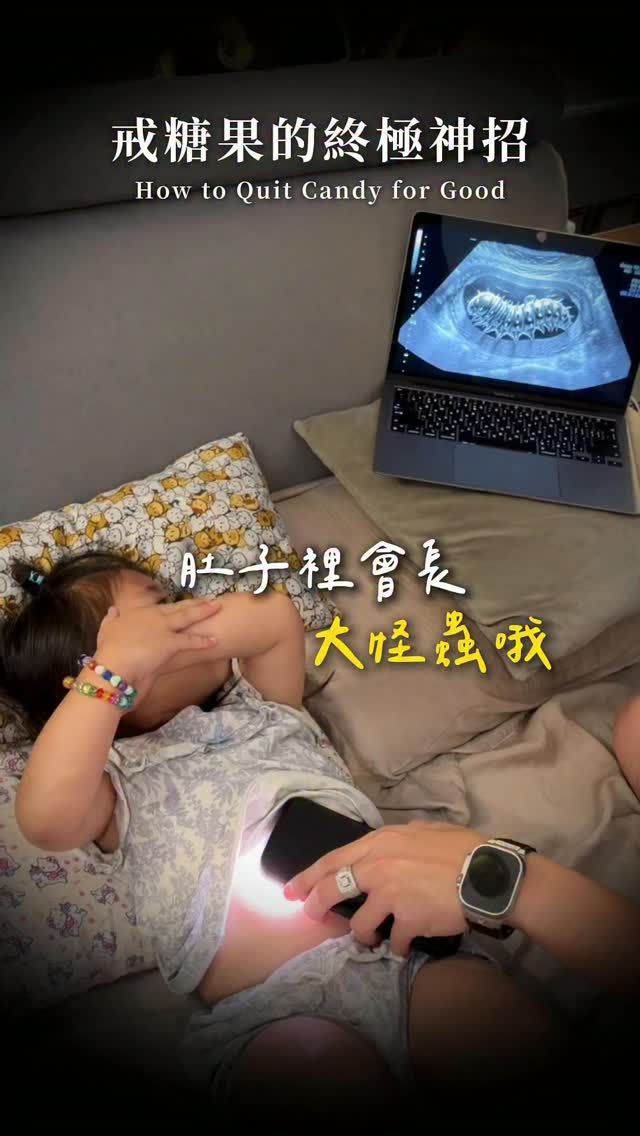 為了讓王蔓以後不要再吃糖果🍬
我們做了一部超音波蟲蟲影片哈哈哈XD
其實平常根本不太會給她吃糖果、巧克力
某天嚐到後 她偶爾就會想吃
身為爸媽的我們開始想辦法阻止✋🏻✋🏻✋🏻
:「妳看!吃太多糖果 肚子裡會有蟲蟲喔😱」
甚至還特地做了超音波蟲蟲影片給她看🪱
王蔓看得超認真 也相信了😌
哭得稀裡嘩啦~答應我們之後不再吃糖果!
不知道這招可以撐多久
但先不管了 能成功一天是一天🤪😎😆
#肚子有蟲蟲 #育兒日常 #禁止吃糖 #哭哭小娃 縮圖