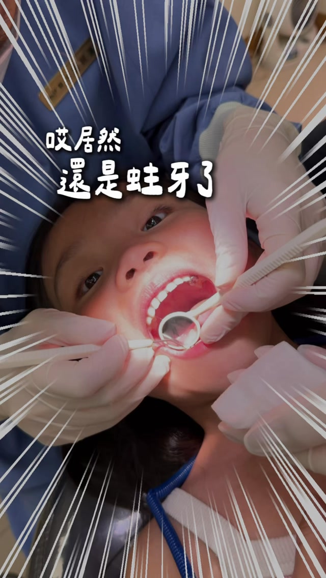 🪥 孩子明明每天刷牙,為什麼還是可能蛀牙?
這次帶孩子看牙醫,發現蛀牙有好幾顆,
真的讓我重新檢視一件每天都在做的事——
「刷牙」不代表「刷乾淨」。
尤其小孩在學習自己刷牙的階段,
很常出現這幾個狀況👇
❌ 刷沒多久就說「好了」
❌ 只刷前面的牙齒
❌ 後面的大臼齒很容易漏掉
❌ 刷牙角度、位置還抓不好
❌ 覺得嘴巴有刷過,就是完成任務😂
其實對小孩來說,
「自己會刷」跟「刷得夠完整」是兩件事情。
所以現在我家的方式是:
孩子先自己刷 → 練習自主 → 媽媽最後檢查、必要時再補刷。
我也會利用有計時提示的電動牙刷,
讓孩子知道刷牙不是隨便嚕兩下就結束,
而是要把時間好好完成。
尤其小珍珠現在6歲,
開始可以自己刷完,再讓我檢查,
我真的覺得這就是媽媽最想看到的進步❤️
至於兩個4歲的,
我目前還不會要求他們完全自己刷,
但讓他們先練習、建立刷牙的習慣,
對我來說也是很好的開始。
所以電動牙刷對我來說,
不是「買了就不用媽媽管」,
而是幫孩子練習自主,也幫媽媽省一點力氣。
三寶媽最希望的,
不是孩子什麼都自己來,
而是有一天,他們真的能慢慢學會照顧自己。
👇 來做個媽媽刷牙調查!
你家孩子現在是哪一派?
① 自己刷,但媽媽最後一定會補刷
② 媽媽刷比較快,直接媽媽來 😂
③ 自己刷+媽媽檢查
留言 1、2、3 告訴我👇
我想看看哪一派最多!
想知道我家三個孩子現在使用的電動牙刷,
留言 「牙刷」,我把資訊傳給你🪥
#蛀牙 #刷牙 #刷牙不再打仗 #兒童電動牙刷 #kinyo 縮圖