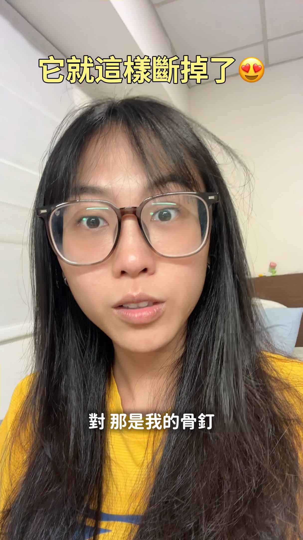 誰矯正牙齒骨釘可以斷在裡面😌
喜提一個紀念品😍😍

#牙齒矯正 #骨釘 #牙套 縮圖
