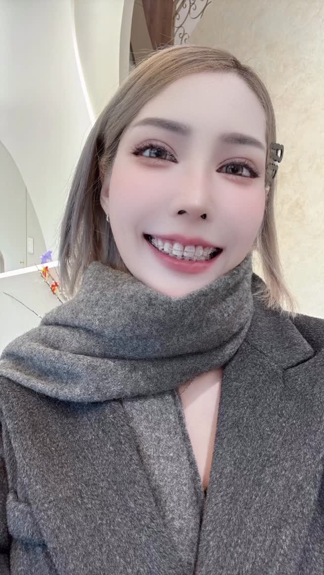 現在麗彤生醫的鈦淨白
已經是我每個月保養的療程之一了
我愛喝茶跟咖啡,所以牙齒很容易黃掉
有帶牙套又有橡皮筋
不管怎麼刷牙都還是看起來牙齒髒髒黃黃的
讓我每次都不敢開口大笑
鈦淨白不使用過氧化氫
而且鈦淨白技術是由日本引進的喔!
日本人對牙齒有多注重
相信不用我多說了吧🥰
鈦淨白可以有效去除
牙齒表層長期累積的色素與污垢
讓牙齒恢復潔白光澤
呈現出自然、乾淨的齒色狀態
看看我的牙齒就知道了!
@deesse.vivante_stores
📍 麗形生醫 竹北館
📞 0800-885-058
📍 新竹縣竹北市光明六路東二段58號
#麗彤生醫 #DÉESSEVIVANTE #我的保養日常 #好物分享 #真實推薦 縮圖