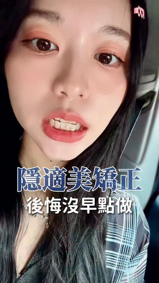 原本很擔心戴牙套會有酸痛感
沒想到根本多慮了😂
可能因為是輕矯正,我只有換新牙套的隔天比較痠
其他時間跟個沒事人一樣
而且也不麻煩!!一天吃兩餐跟一般人一樣只需要刷兩次牙
還因為這樣默默瘦了兩公斤😂
現在真的只有後悔沒有早點做
想矯正牙齒的不要猶豫,直接去找蘇孟狄醫師做隱適美!
🏥時承牙醫診所
📍地址:高雄市鳳山區文德里文衡路458號1樓
🧑⚕️蘇孟狄醫師(醫師時間為排班制,建議先電話詢問)
📞電話:07-7779850
#隱適美 #牙齒矯正 #矯正日記 縮圖