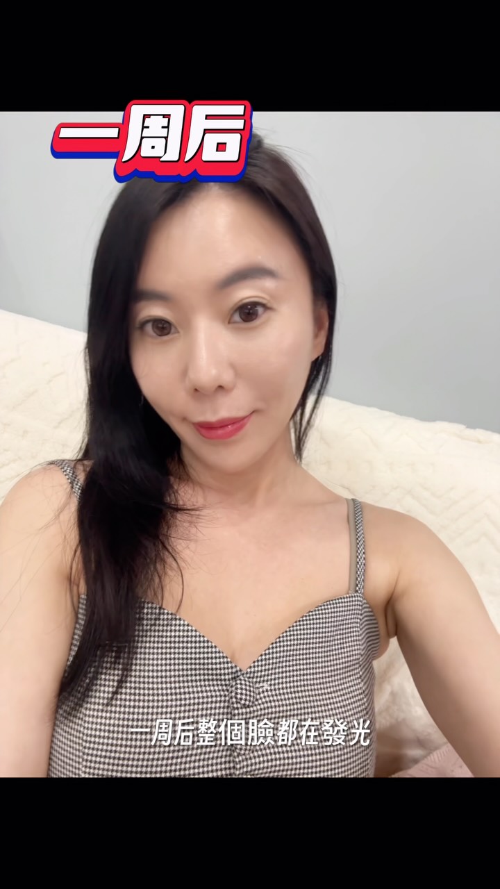 最近看到鏡子裡的魚尾紋真的差點氣死！直接跑來蜜絲歐妮找醫師救急 💆‍♀️
醫師幫我規劃了肉毒＋水光槍：
✔️ 肉毒：幫忙緊緻毛孔、拉提下顎線
✔️ 水光：補滿水份、提升整體光澤
重點是這台水光槍過程真的沒什麼痛感，看我打的時候連眉頭都沒皺一下！
一週後那個發光感跟緊緻度真的很有感～✨#肉毒 #水光 #下顎拉提 縮圖