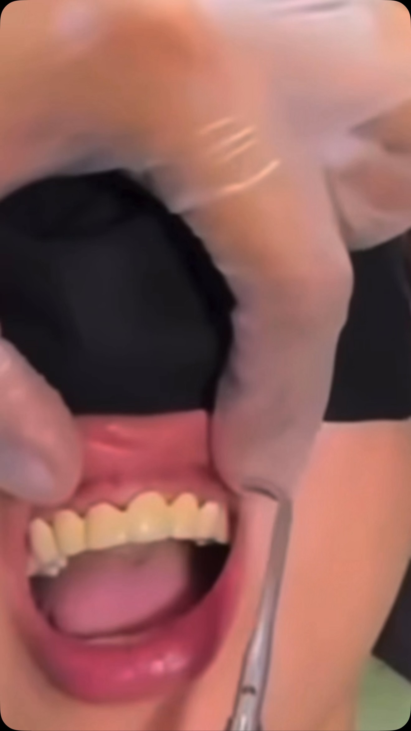 萌弟不好好刷牙,所以我給他看這部影片……🤣🤣🤣🤣 縮圖