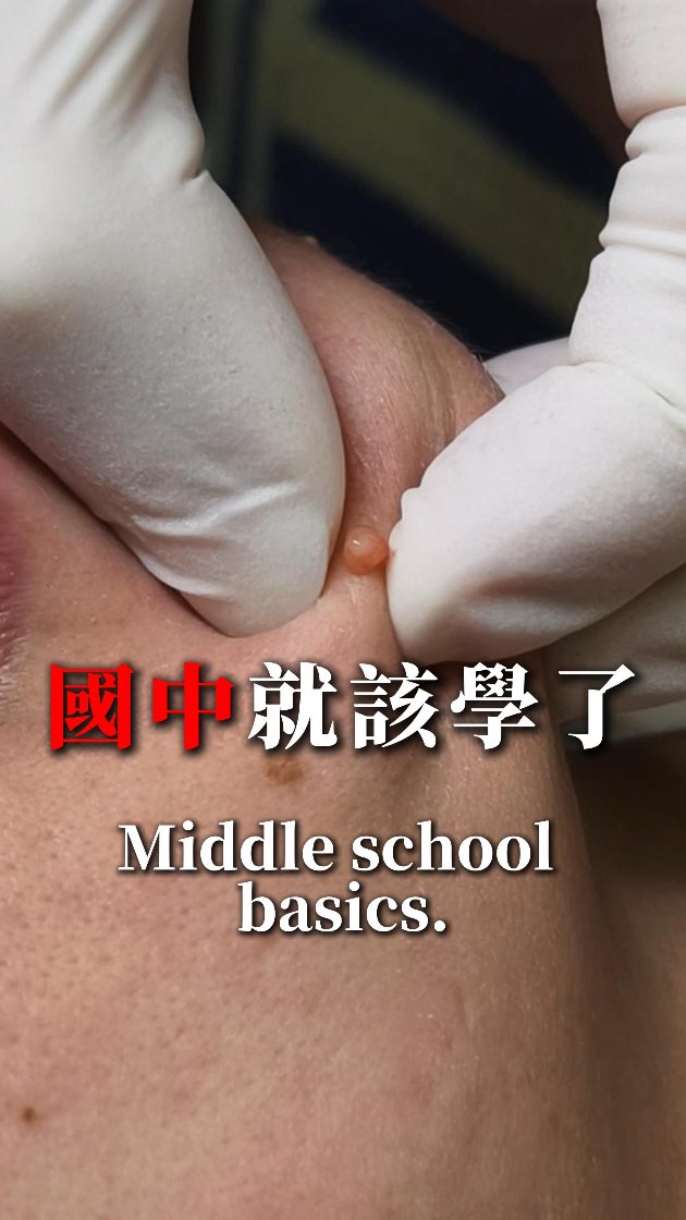 學習如何完美的處理皮膚問題 縮圖