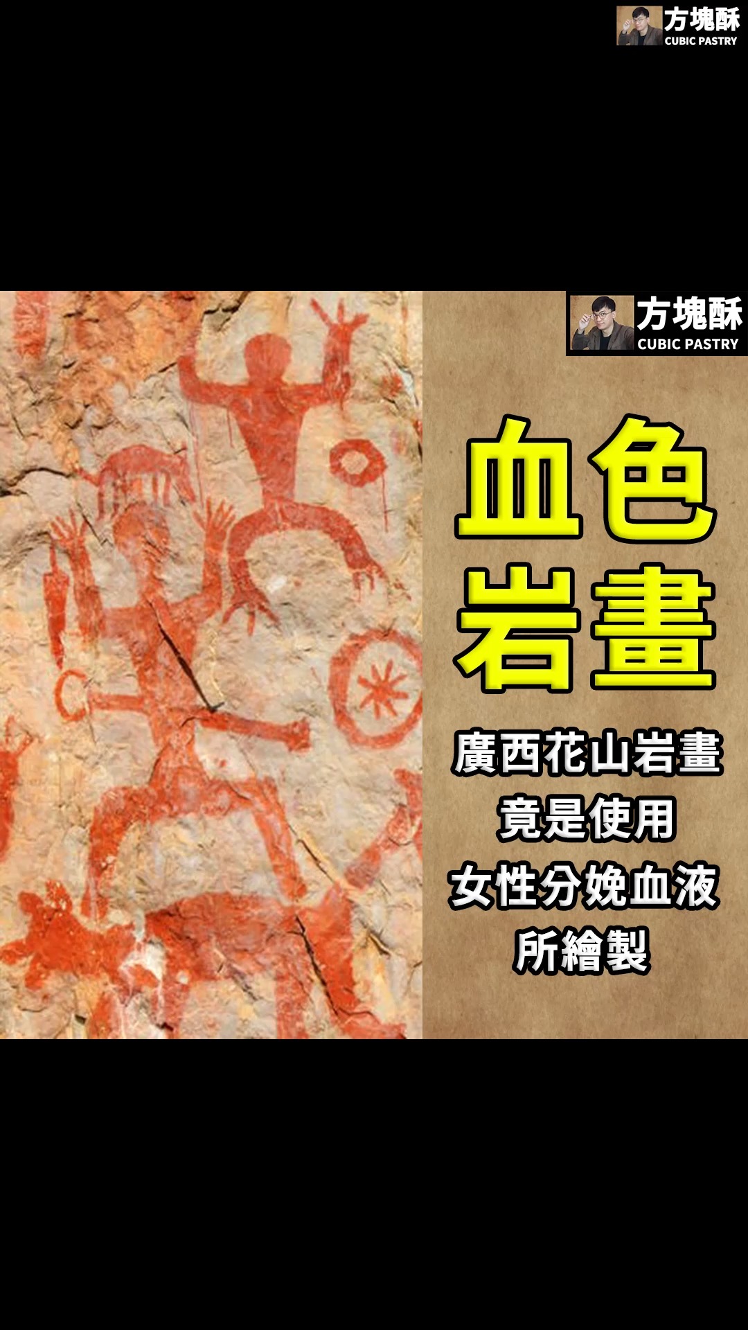 【古代岩畫中竟驗出女性分娩流出的血液?中國廣西花山岩畫背後母系社會與生殖崇拜的密碼】
中國廣西壯族自治區左江河谷的懸崖峭壁上,存在著神祕的岩畫-花山岩畫;根據考古與歷史文獻推斷,花山岩畫的誕生時期介於春秋時期至東漢(西元前770年-西元220年),放射性碳定年結果指出岩畫創作於距今2370-2115年前,鈾釷定年法則指出岩畫的年代為距今1856 ± 16 至 1728 ± 41年前;岩畫的繪製者可能是當時居住在左江流域的民族「駱越」。
而在2026年8月在《考古科學期刊(Journal of Archaeological Science)》上,來自山東大學考古學院主導的研究團隊,透過拉曼光譜、傅立葉紅外光譜(FTIR)、掃描電子顯微鏡結合能量散射X射線光譜儀(SEM-EDS)與蛋白質組學分析(proteomic analysis),分析其岩畫的分層及顏料的組成與結構,結果發現了岩畫千年不朽的秘密-原來岩畫中含有大量人類血液,並且來自女性分娩時流出的血液!
■岩畫保持千年不朽的秘密
為了解岩畫顏料的成分以及岩畫經歷千年不朽的秘密,研究團隊首先在花山岩畫所在的高山(Gaoshan,音譯)、丹寧山(Daningshan,音譯)與屯坪山( Tunpingshan ,音譯)三處遺址,採集掉落下的岩畫碎塊及未帶有岩畫的自然沉積物樣本,以及從岩畫上刮下2平方公分的顏料樣本進行分析;另外為了推測顏料的成分,研究團隊還收集赤鐵礦(Hematite)、紅色黏土與紅色砂子做為樣本。
蒐集完樣本後,研究團隊使用傅立葉紅外光譜確認顏料與其中黏合劑的礦物成分,掃描電子顯微鏡結合能量散射X射線光譜儀用來觀察樣本中的顆粒大小與元素分布,蛋白質組學分析是以液相色譜與質譜聯用技術(LC-MS/MS)分析岩畫中可能的蛋白質成分。
結果發現,岩畫的結構可以分為三層,從內到外分為岩壁、底漆與顏料三層。
岩畫的繪製過程是首先刷上一層由熟石灰、骨粉(磷酸鈣,文中說明可能來自動物骨骼與鳥糞)與血液調和成的底漆,當底漆半乾時,古人便以顏料在底漆層上作畫,岩畫的顏料根據分析,來自於富含氧化鐵的紅黏土,氧化鐵是團聚的奈米顆粒。
岩畫繪製時,底漆中的熟石灰會與空氣中二氧化碳相互反應,形成碳酸鈣,而底漆裡含血液中的蛋白質會誘導碳酸鈣(粒徑<3 μm)發生生物礦化作用,顏料的顏色會隨著碳酸鈣結晶逐漸地一同生長進崖壁的岩石中並相互結合。
此外,將血液與底漆混合,可以有效阻止血液快速凝固與被微生物分解,延長了底漆的保存期限,使其可以在大量製作後使用並保存數日甚至數月之久 ,可見岩畫背後古人的智慧。
那麼,既然測出底漆的成分中含有血液,這些血液的來源又是從哪裡呢?
■岩畫中的血液來自女性分娩時流出的血液
研究團隊從岩畫樣本中提取了微量的蛋白質,並透過蛋白質組學分析檢測到多種人類血漿中的蛋白質,例如白蛋白(Albumin)、補體C3(Complement C3)、纖維蛋白原(Fibrinogen)等,這說明岩畫中含有人類的血液,同時混合少量的動物血液。
例如在高山遺址的岩畫中,檢測出人類血液的比例高達97%至99%,而動物血液約占1%至3%;丹寧山遺址的岩畫則檢測出含有61%的人類血液與39%的牛血。
最為關鍵的是,研究團隊檢測到了在血漿中,一般情況下含量極低的兩種蛋白質-催乳素誘導蛋白 (prolactin-inducible protein)與乳鐵蛋白 (lactotransferrin) 。
這兩種蛋白質在男性與未生育女性的血漿中含量極小,但是在懷孕後期和哺乳期的女性血漿中,這兩種蛋白質的含量會增加至數十倍;這些蛋白質主要由女性的乳腺細胞分泌,在母乳中含量最豐富,但也在其他體液中存在 。
然而通過檢驗,研究團隊發現岩畫樣本中並未檢測到母乳中的主要蛋白質-酪蛋白 (casein),因此排除了直接使用母乳的可能性。
由於催乳素誘導蛋白與乳鐵蛋白在懷孕後期與哺乳期女性的血液中濃度顯著升高,因此研究團隊們推測,這些在岩畫樣本中檢測到的兩種蛋白質,更可能源自於懷孕女性流出的血液。
結合花山岩畫中描繪的生殖器、性愛與孕婦等與生殖相關的圖像,結合從史書中發現駱越民族屬於母系社會的記載,研究團隊進一步推測,這些血液很可能是在女性分娩時或分娩後流出的血液,這些血液被有意識地收集起來並用於岩畫創作 。
這可能顯示,在駱越民族的文化中,分娩很可能被賦予了極高的神聖意義,因此分娩時或分娩後流下的血液,才會被小心翼翼地收集起來,作為岩畫中底漆的主要成分,可能是對生命起源、女性生殖的創造力與對豐饒和繁衍的祈願,融入岩畫的繪製過程中。
儘管對於今天的人們來說有些驚悚,不過當我們理解後,才會發現千年前那一些對女性的讚頌與繁衍的祈願真正透過繪製的過程傳達給千年之後的我們,這是屬於人類的讚歌!
參考文獻:Blood-induced biomineralized calcium carbonate used for binding in the Huashan rock art of Guangxi, Southern China(Journal of Archaeological Science)
#考古#考古學#考古學家#岩畫#懷孕 #孕婦#女神#儀式#媽媽 縮圖