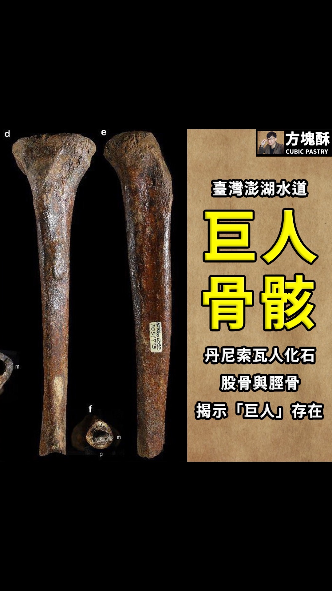 【澎湖水道丹尼索瓦人竟是巨人!臺灣舊石器時代考古學最新突破!】
丹尼索瓦人(Denisovans)一直是更新世晚期充滿謎團的古人類群體,根據出土於西伯利亞丹尼索瓦洞穴出土的指骨與牙齒化石、中國甘肅省夏河縣的下頷骨、中國黑龍江省的「龍人」頭骨化石,以及2025年發表在《科學(Science)》期刊上打撈自澎湖水道的「澎湖原人(澎湖一號)」下顎骨等化石材料的研究,目前我們可以得知這種古人類在演化樹上,約在距今55萬年前與尼安德塔人分道揚鑣,後來廣泛分佈於東亞地區,直到距今約4.5萬年前才走向滅絕。
2025年發表在《科學(Science)》期刊上打撈自澎湖水道的「澎湖原人(澎湖一號)」下顎骨化石的研究,通過古蛋白質分析,學者指出該化石屬於丹尼索瓦人所有,如今對於澎湖水道新的人骨化石的研究則為我們了解丹尼索瓦人又有了全新的認識。
█澎湖水道的古代巨人
2026年8月8日,在bioRxiv論文預印本平台上,來自臺灣國立自然科學博物館、國立臺灣大學與日本東京大學組成的跨國研究團隊,透過2010年,由臺南資深的化石收藏家-侯立仁老師,所捐贈的打撈自澎湖水道的兩塊古人類股骨(澎湖2號)與脛骨(澎湖3號)化石,進行古蛋白質組學分析與骨骼形態學分析,不僅確認了這兩件化石屬於丹尼索瓦人,更驚人地揭示了丹尼索瓦人的身高宛如巨人般高大且壯碩,直接挑戰了學界對更新世晚期東亞古人類體型的既有認知。
為了精確鑑定這些骨骼的物種歸屬,研究團隊採用了古蛋白質組學(palaeoproteomic)分析技術,從化石內部鑽取骨粉並提取、分析其中的古蛋白質,並使用液相色譜串聯質譜法(LC-MS/MS)進行測序。
結果顯示,兩塊化石的膠原蛋白I α2鏈中,都帶有丹尼索瓦人特有的衍生氨基酸變體-COL1A2 R996K。
此外,團隊還對兩件化石進行系統發育分析 (Phylogenetic Analysis),利用最大似然法 (maximum-likelihood, MLE)與貝葉斯方法(Bayesian methods)構建了基於15種蛋白質序列的系統發育樹,系統發育樹被設計來準確反映智人、尼安德塔人、丹尼索瓦人以及其他靈長類之間的演化關係。
結果顯示,兩塊人骨化石在系統發育樹中,都與先前發現的「澎湖一號」下顎骨與「丹尼索瓦三號」指骨化石緊密分群(Close Clustering),即相似度極高,這讓兩塊化石的丹尼索瓦人身份得到了確鑿的分子生物學證據支持。
研究團隊還使用放射性碳定年法,對脛骨(澎湖3號)化石的年代進行年代測定,結果指出該化石的年代,約在距今4.5-4.3萬年前,這個時候屬於海洋同位素第3階段(MIS 3,距今5.9-2.4萬年前),顯示丹尼索瓦人在東亞地區的廣泛分布與生存時間。
█巨人現身!
本研究最令人震驚的發現,莫過於這些丹尼索瓦人擁有巨大體型!
透過對澎湖2號股骨的重建,研究團隊估計股骨其最大長度約為491毫米,在骨骼長度與中軸厚度方面,是目前發現的全球更新世人屬樣本中最大的股骨之一;澎湖3號脛骨的骨骼中軸的厚度也顯示出極端尺寸,是已知更新世人屬脛骨中最大之一。
結合兩塊化石測得的數據,研究團隊推估這些丹尼索瓦人個體的站立身高可達約180-190公分,體重約為83-91公斤,這使澎湖的丹尼索瓦人躋身全球更新世人屬中體型最大的行列,足以與來自非洲與歐洲的體型較大的更新世古人類化石相媲美。
這個發現與之前對東亞古人類的認知形成鮮明對比,並挑戰了「伯格曼法則(Bergmann’s rule)」,該法則主張即緯度越高(氣候越冷),動物體型就越大;儘管澎湖水道位於東亞相對偏北的緯度,但其澎湖水道丹尼索瓦人的巨大體型,仍然超越了東亞晚更新世的古人類化石的尺寸。
那麼,為什麼澎湖水道丹尼索瓦人會如此高大?
研究團隊推測,這可能與丹尼索瓦人的狩獵策略、飲食結構以及工具使用習慣有關,例如澎湖3號脛骨進行的同位素分析,顯示其大量依賴肉食,這些可能與當時的現代智人有所不同。
研究提到,先前在青藏高原出土的丹尼索瓦人(夏河人下顎骨)群體使用廣泛的動物類群,包括羊亞科動物(Caprinae)、巨型草食性動物與肉食性動物,暗示了丹尼索瓦人普遍具備獵捕多種,甚至大型動物的能力;研究團隊也提出假設,認為澎湖水道丹尼索瓦人的巨大體型與狩獵策略有關,顯示他們可能需要更大的體型與體力來追逐並制服獵物。
此外,丹尼索瓦人的體型與腦容量之間存在直接關聯,研究提到根據對已知的丹尼索瓦人化石標本的骨骼形態學研究,發現大型腦容量是丹尼索瓦人的特徵之一,研究團隊推測造成腦容量大的原因可能部分與其龐大的體型有關。
此次澎湖水道丹尼索瓦人股骨與脛骨的研究,重塑了我們對東亞地區舊石器時代晚期古人類的全新認識,除了讓我們看到丹尼索瓦人在亞熱帶地區的擴散與適應。
本研究強烈證明了東亞地區的古人類演化過程遠比我們想像的要複雜和多樣,隨著古蛋白質組學等分子生物學等技術的進步,這些骨骼化石正以前所未有的細節,向我們講述著關於人類演化和遷徙的宏大故事。
#考古#考古學#考古學家#化石#舊石器時代 #台灣#澎湖#澎湖原人 縮圖
